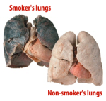 smokers-lungs-comparison1